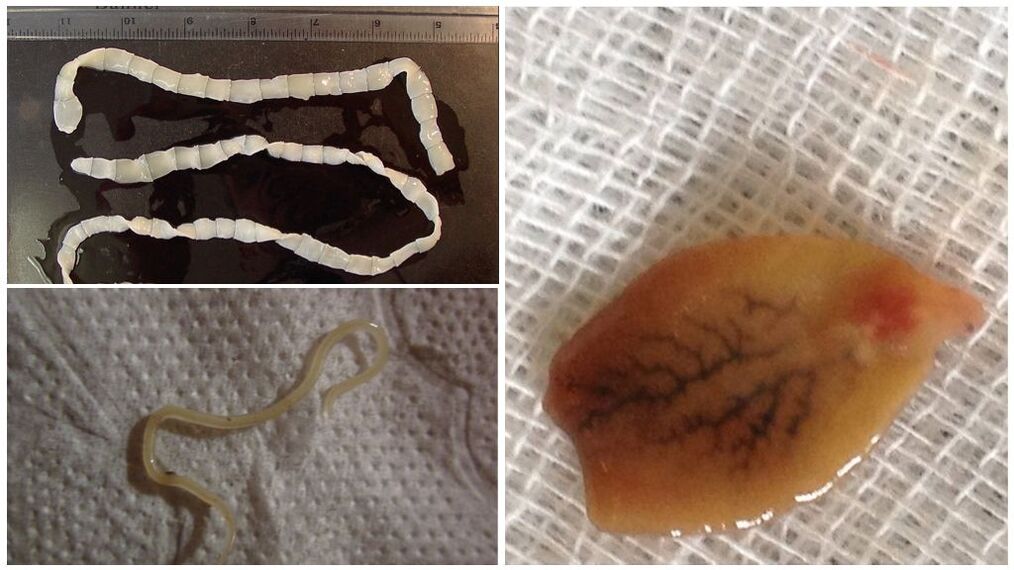 Видове паразити