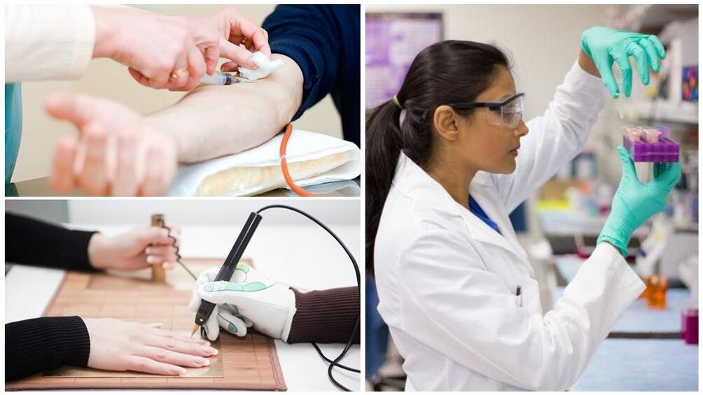 Диагностични методи за откриване на паразити в организма